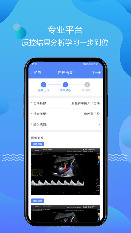 超声智库APP v1.2.23 最新版